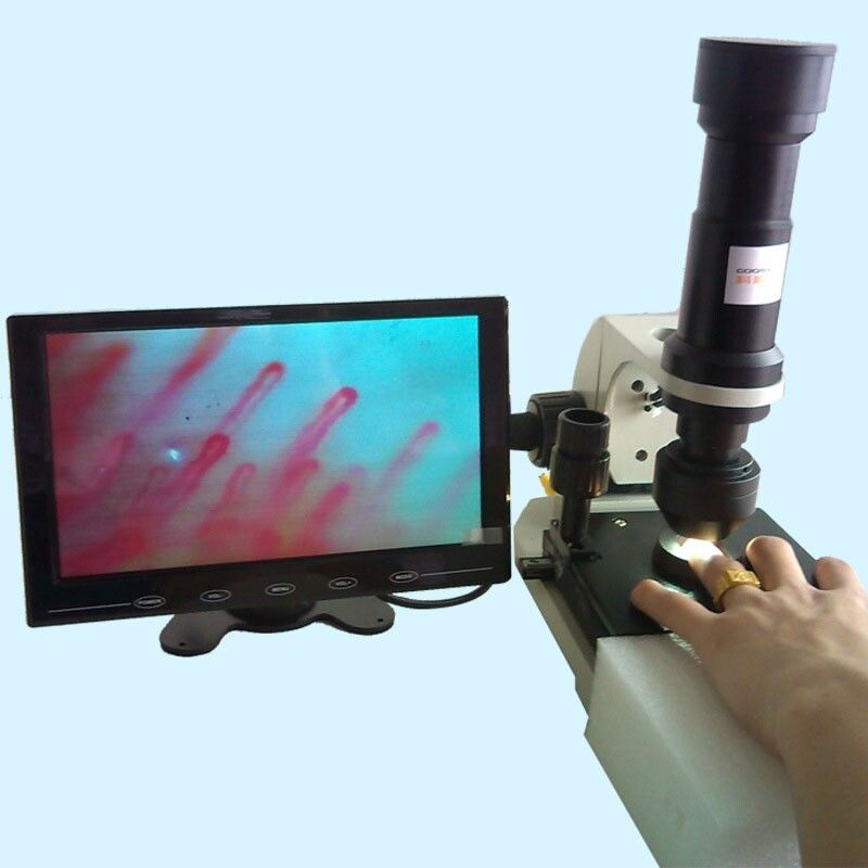 Nailfold Video Capillaroscope Detection Instrument Blood Capillary Microcirculation Microscope