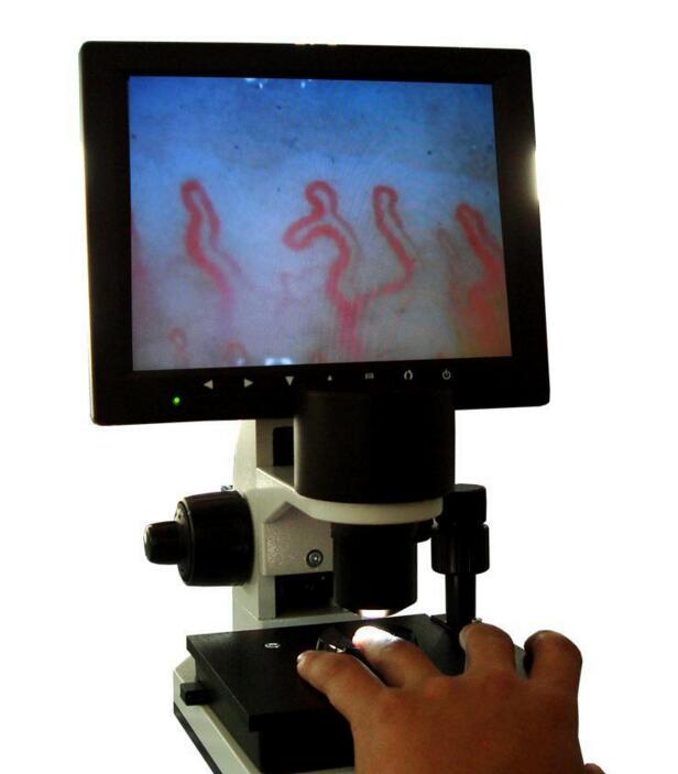 video capillary microscope portable clincial capillaroscope video microcirculation microscope sub-health analyse microscope