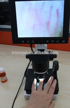 nail fold blood capillary microscope (capillaroscope) with ce certificate