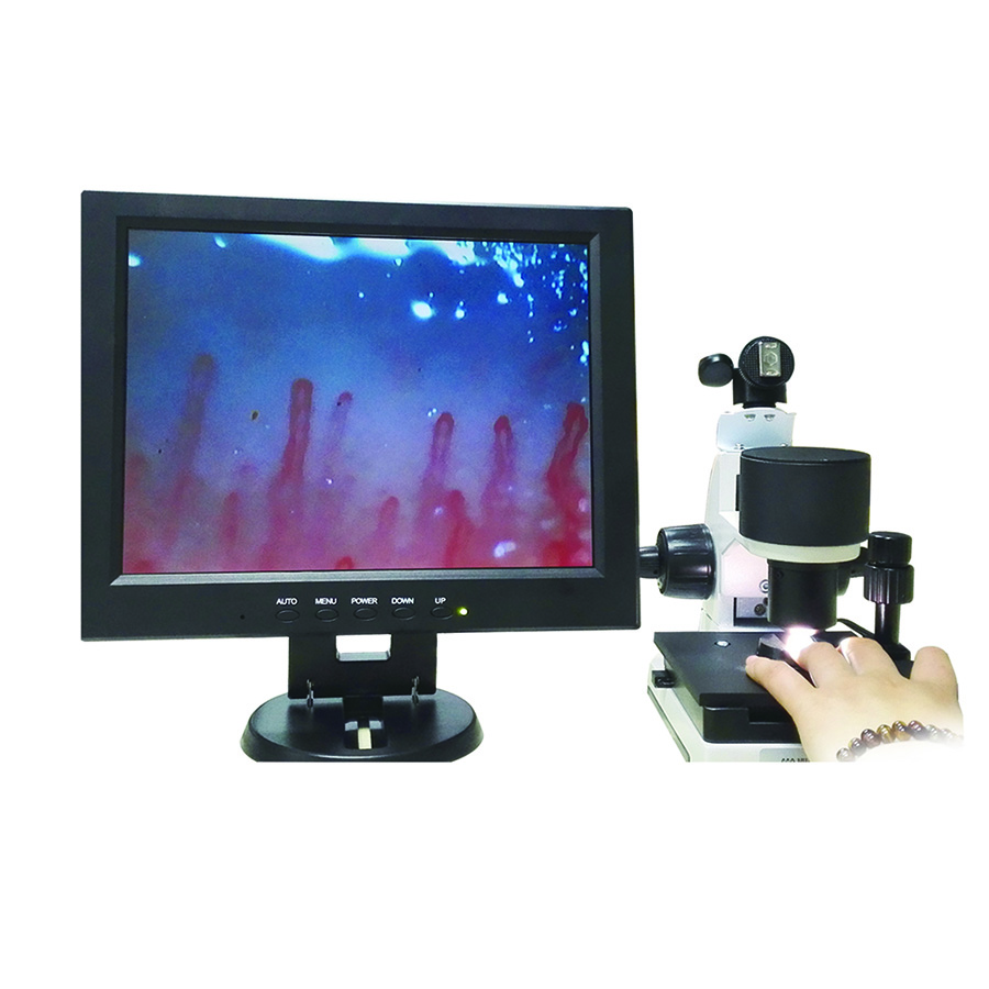 microcirculation microscope malaysia