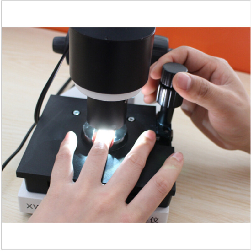 microcirculation diagnosis microscope