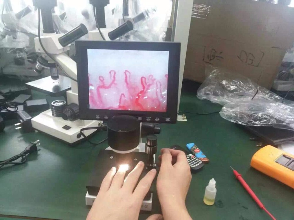 video microscopy microcirculation