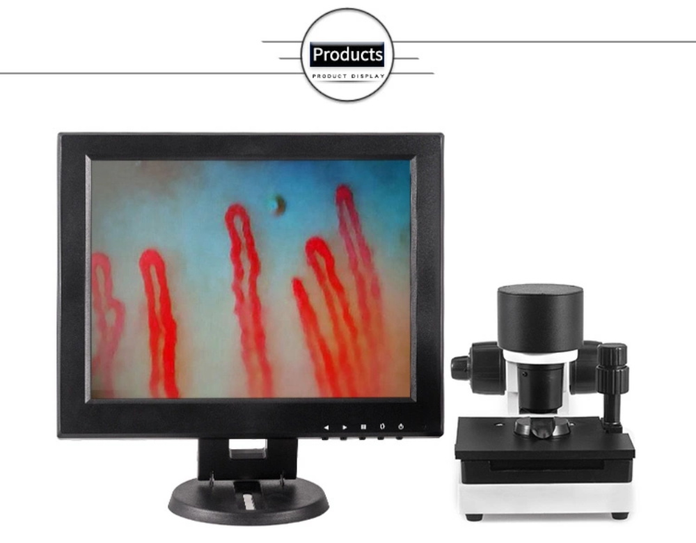 Nail fold microscopy what it how working why it and how get price?