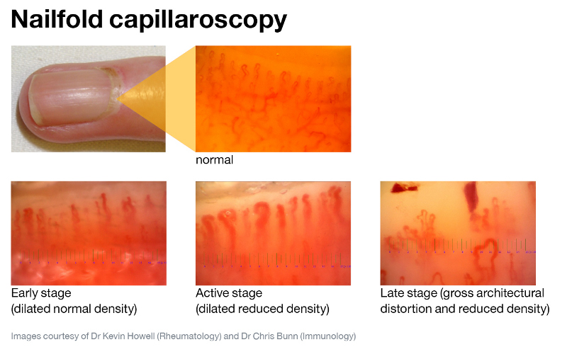 capillary under microscope