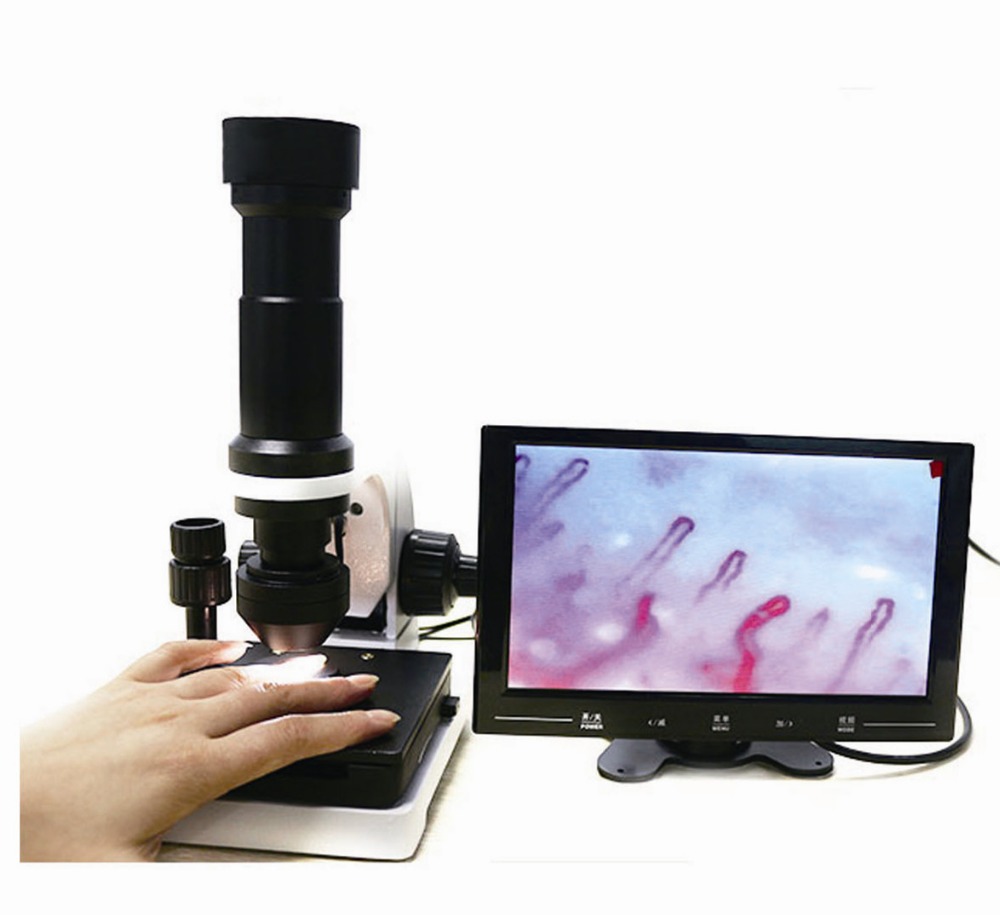 portable xw880 nailfold color LCD microscope for sale with ce certificate