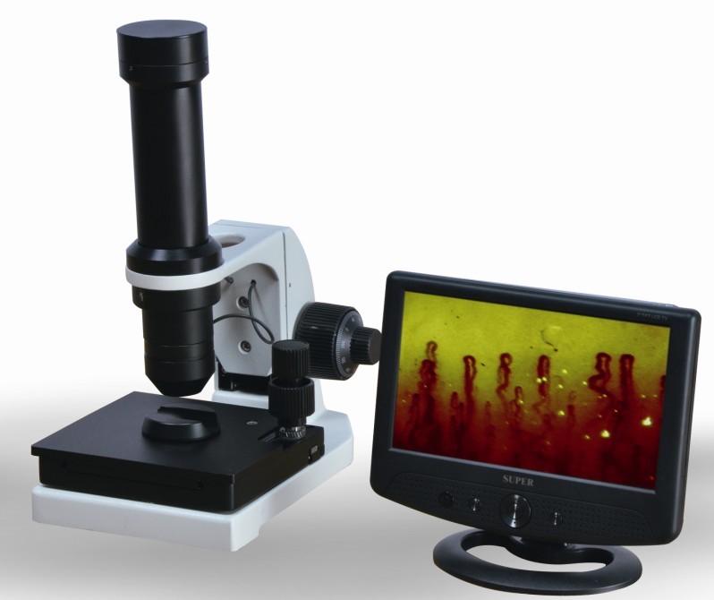 nail fold capillary microscope portable clincial capillaroscope microcirculation microscope microcirculation analyse microscope