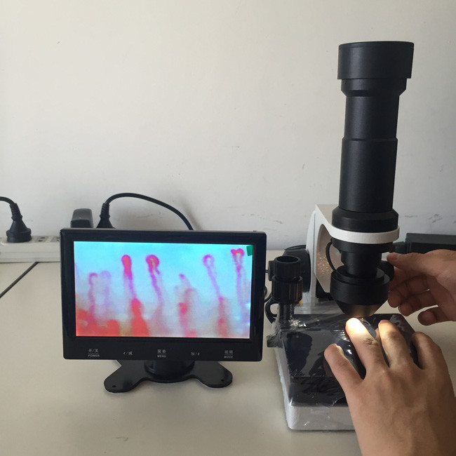 vedio capillary nail fold microcirculation microscope with china factory price