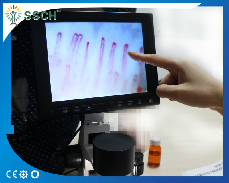 xw880 health nail fold capillary checking microscope with CE