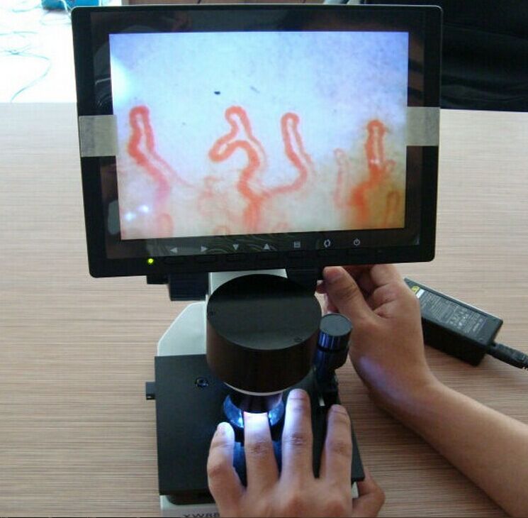 fingernail microscope