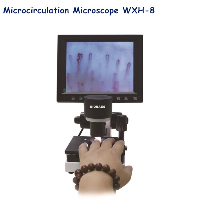 microcirculation microscope bacteria
