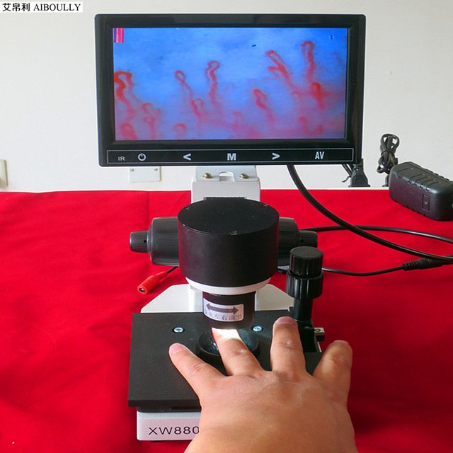 Professional Nailfold Capillaroscope Systems