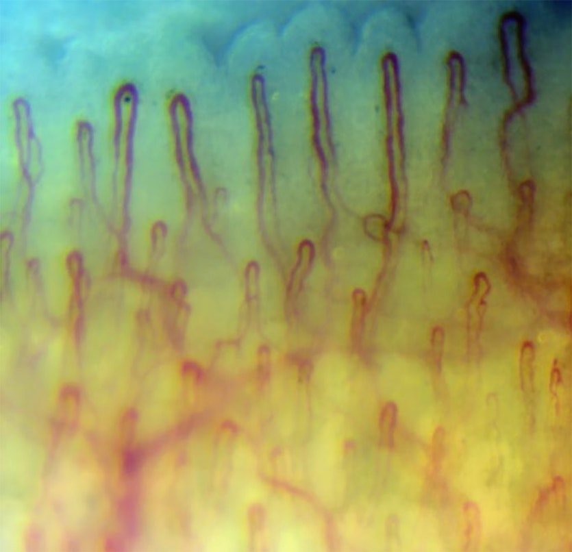 Microcirculation Microscope