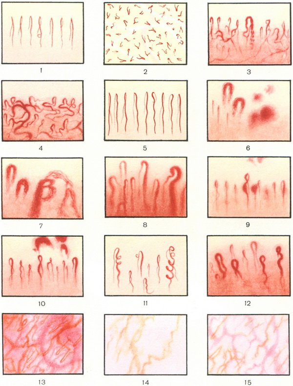 Dorsal Nail Fold