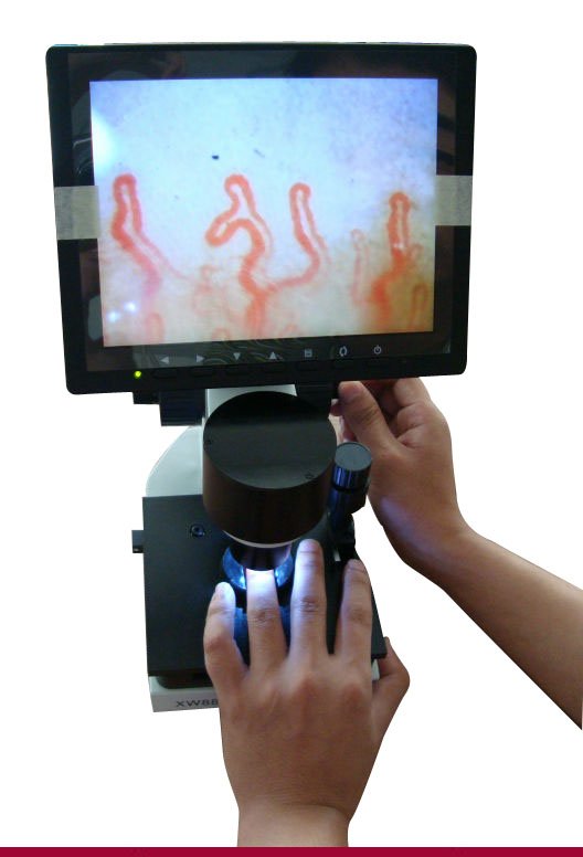 Capillaroscopy: Non-Invasive Microvascular Imaging and Evaluation Methods