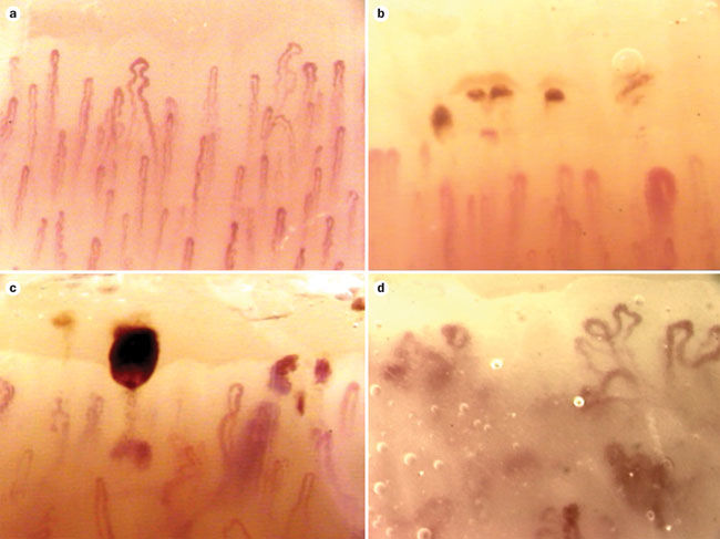 capillary under microscope