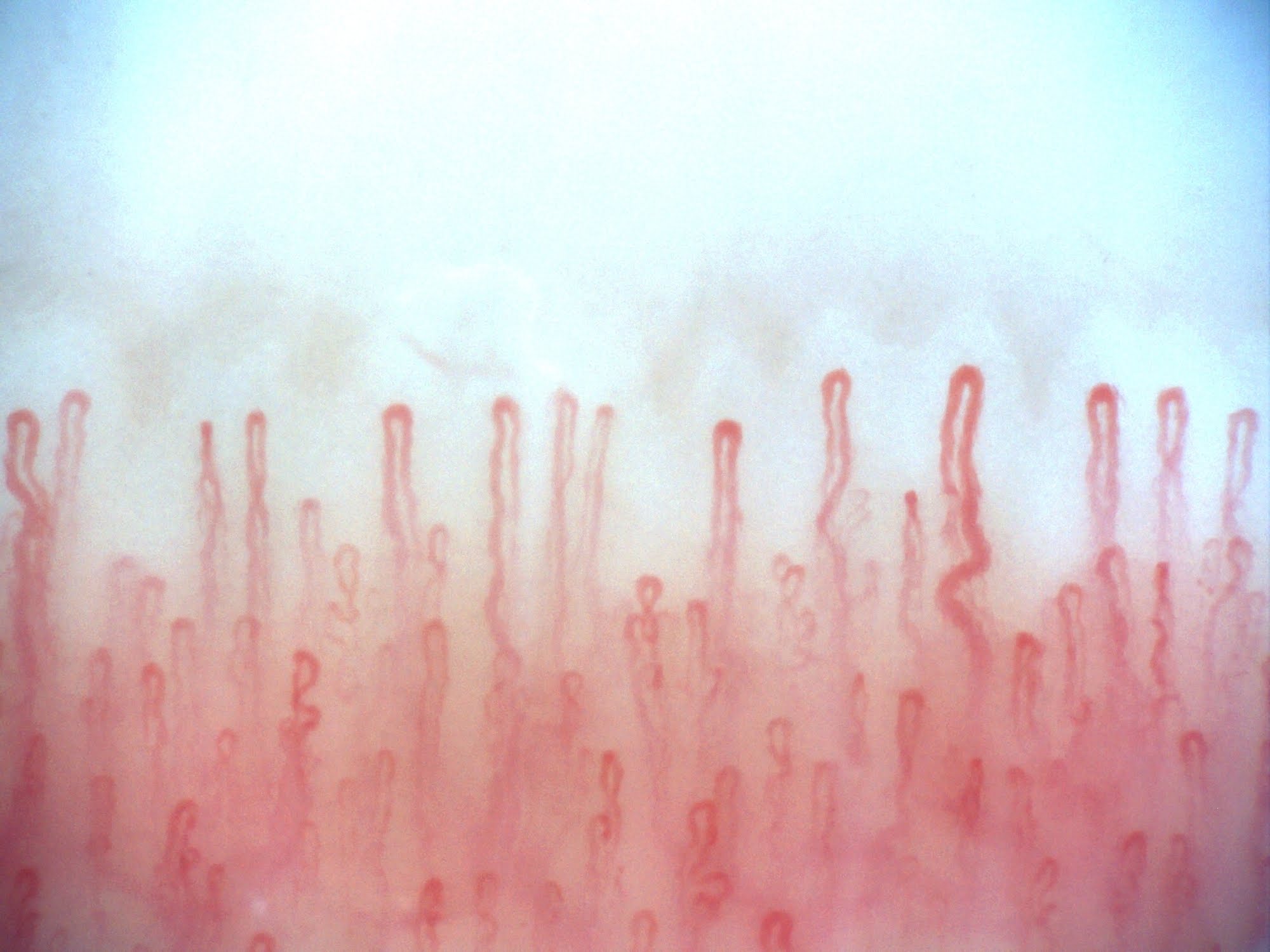 Microscope Nail Blood Circulation