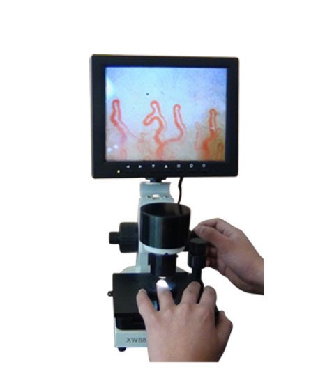 Nailfold Capillaroscopy Procedure