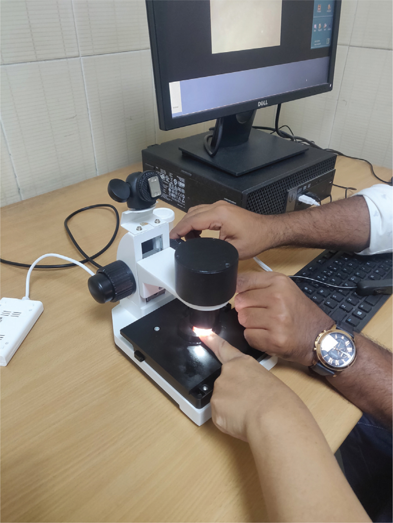 the handheld dermatoscope as a nailfold capillaroscopy instrument