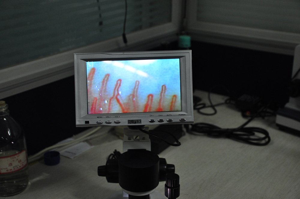 Microcirculation Microscope
