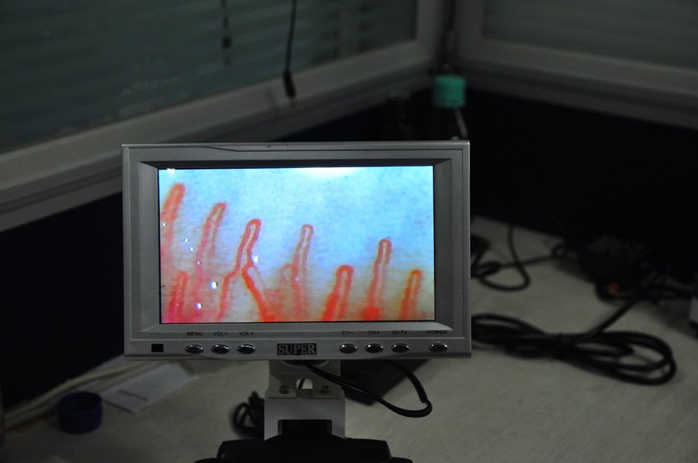 Microcirculation Microscope