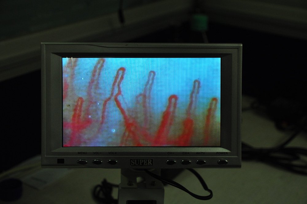 Microcirculation Microscope