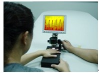 Microcirculation Video Microscope