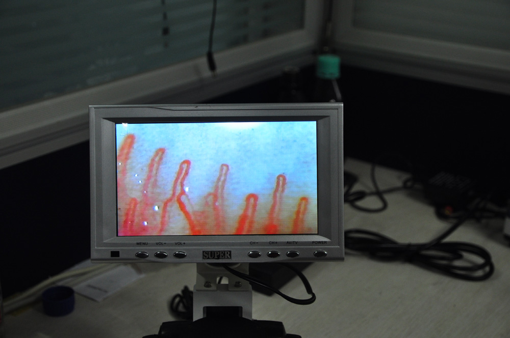 Microcirculation Video Microscope