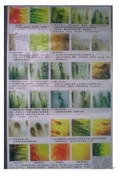 Microcirculation Microscope