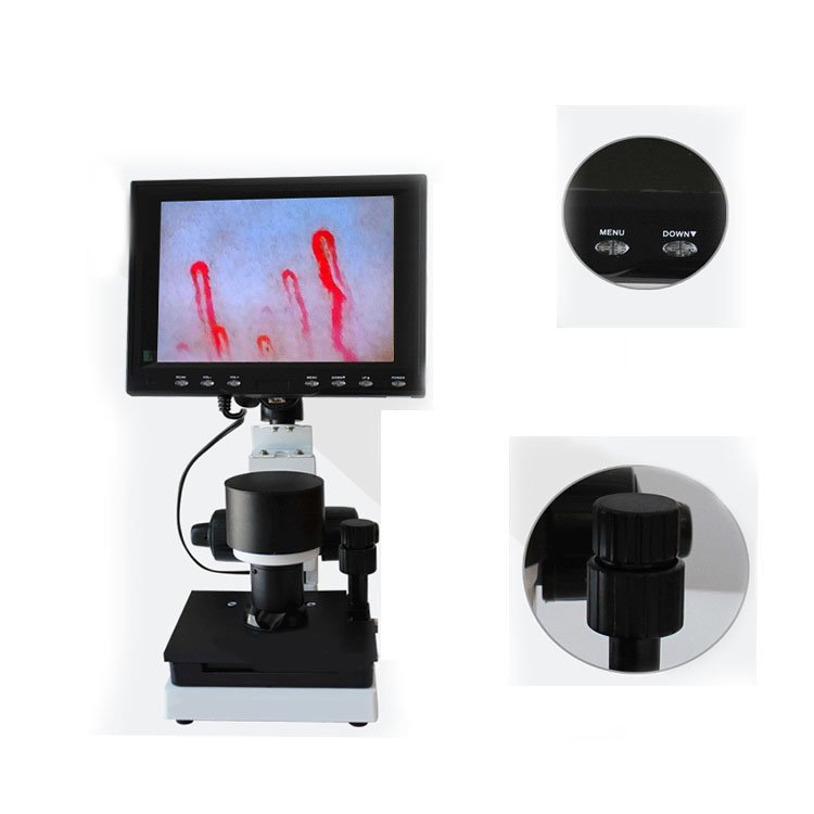 Nailfold Capillaroscopy Test Cost