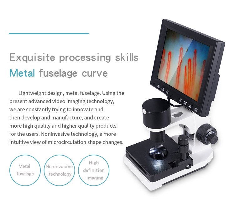 The Revolution of Nail Bed Capillaroscopy with MAIKONG Capillary Microscopes