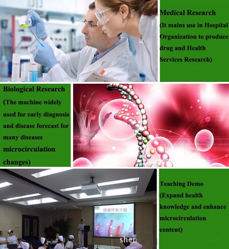 nailfold video capillaroscopy