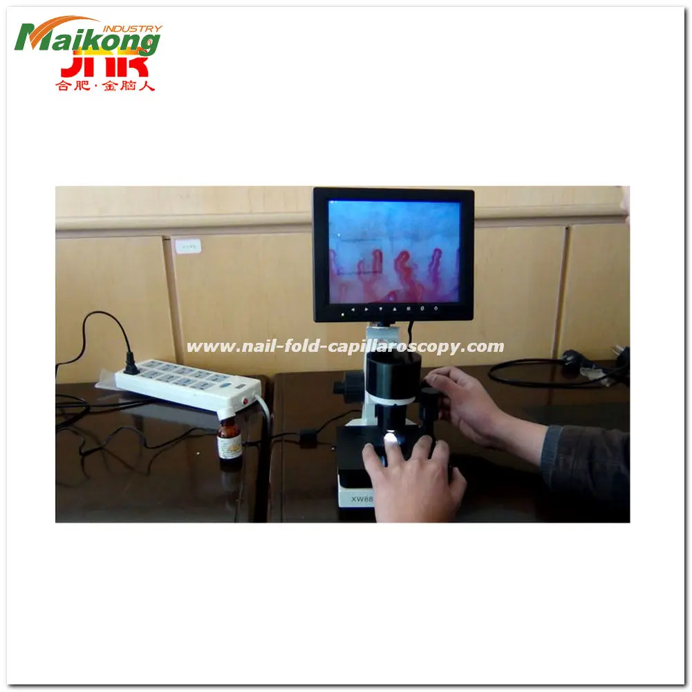 Nailfold Capillaroscopy in Systemic Sclerosis