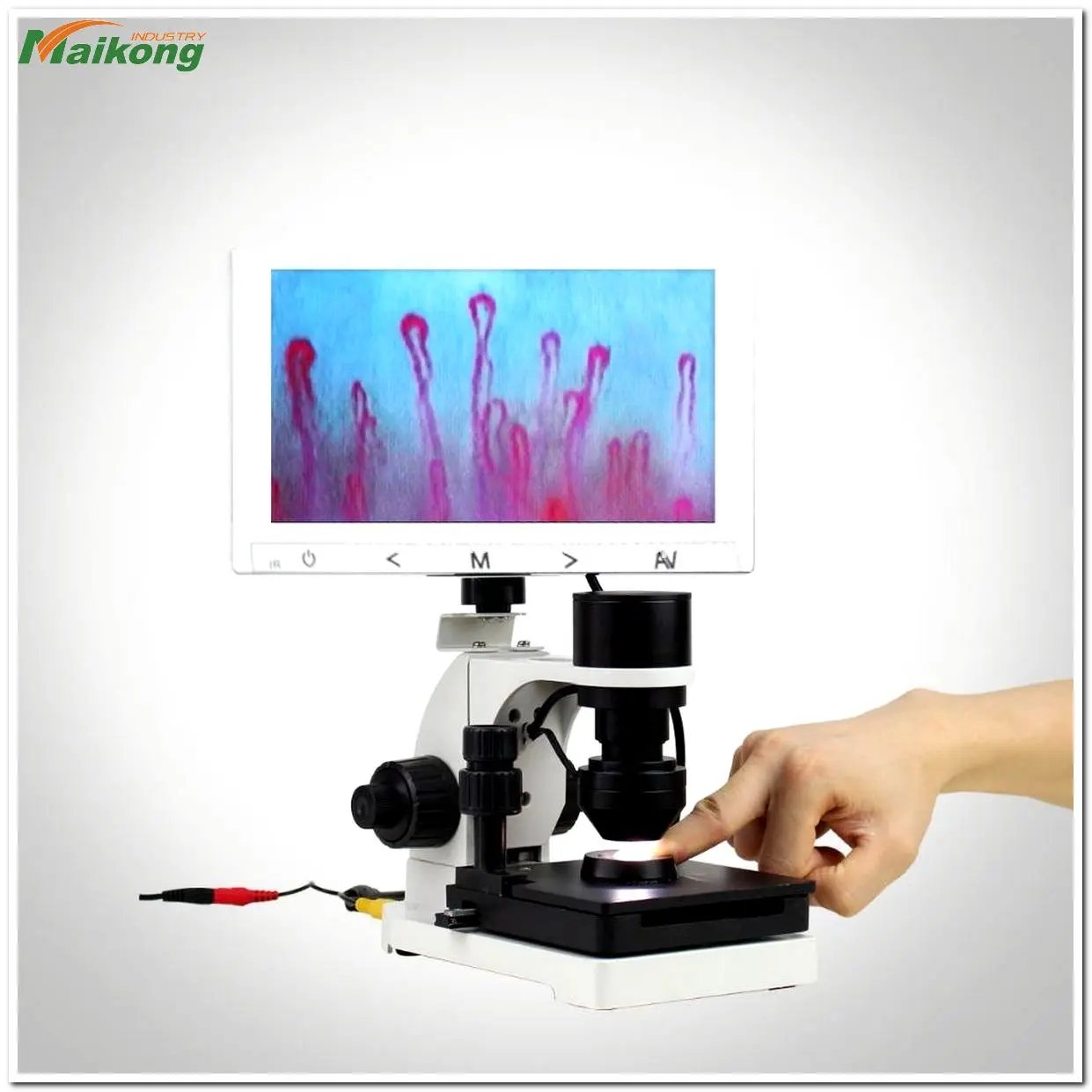 Nailfold Capillaroscopy in Systemic Sclerosis