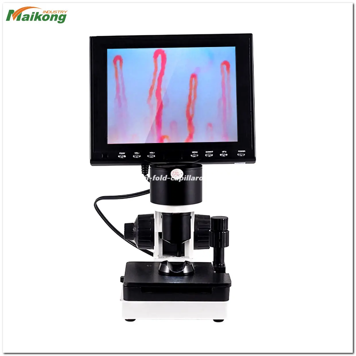 Nailfold Capillaroscopy in Systemic Sclerosis: A Revolutionary Diagnostic Tool