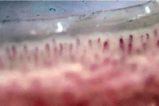 Who Leads in Digital Nailfold Capillaroscopy Equipment — Practical Answers for Portable Buyers — nail fold vasculature capillaroscopy 9 - 副本.JPG