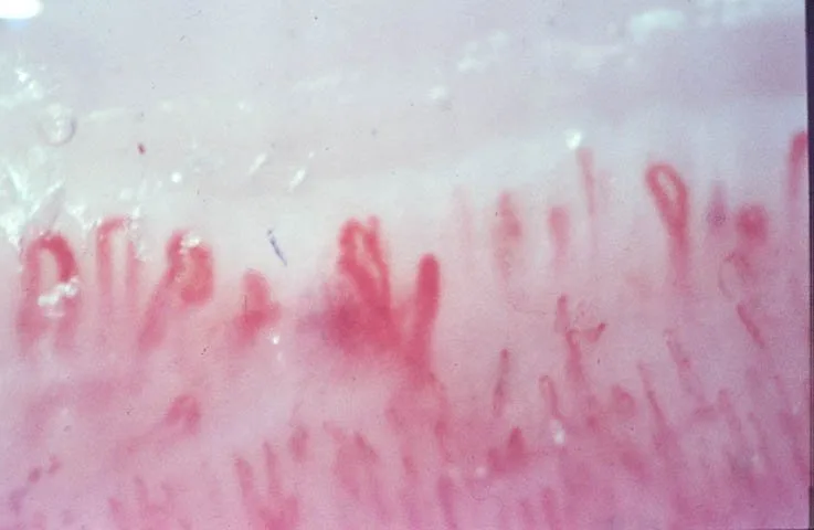 How pharmaceutical research organizations in the U.S. choose a reliable capillaroscopy equipment supplier for wholesale — nail fold vasculature capillaroscopy 7 - 副本.jpg