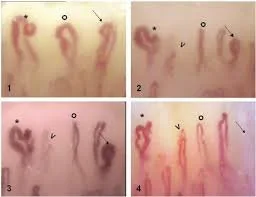 Can a handheld nailfold capillaroscope deliver gtm latency=1? Practical answer for U.S. handheld users — nail fold microscopy 8 - 副本.jpg