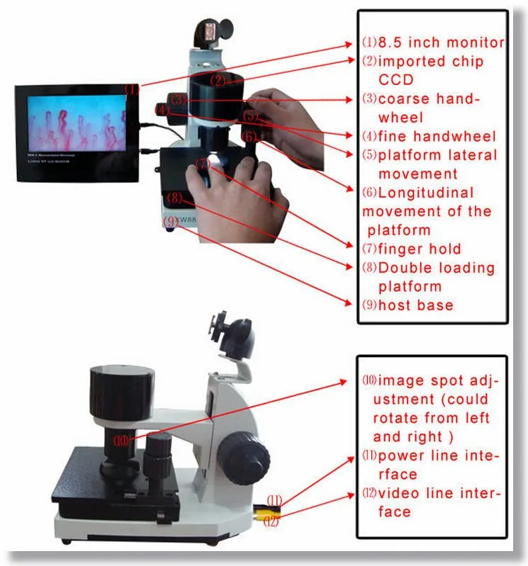 Which companies supply nail fold capillaroscopy equipment to the United States? — Dr. Klopp Microscope Microcirculation (7).jpg