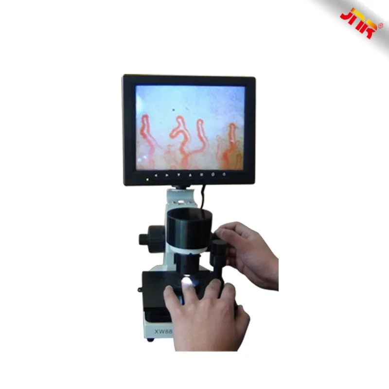 Can a handheld nailfold capillaroscope deliver gtm latency=1? Practical answer for U.S. handheld users — nail fold microscopy 10 - 副本.jpg