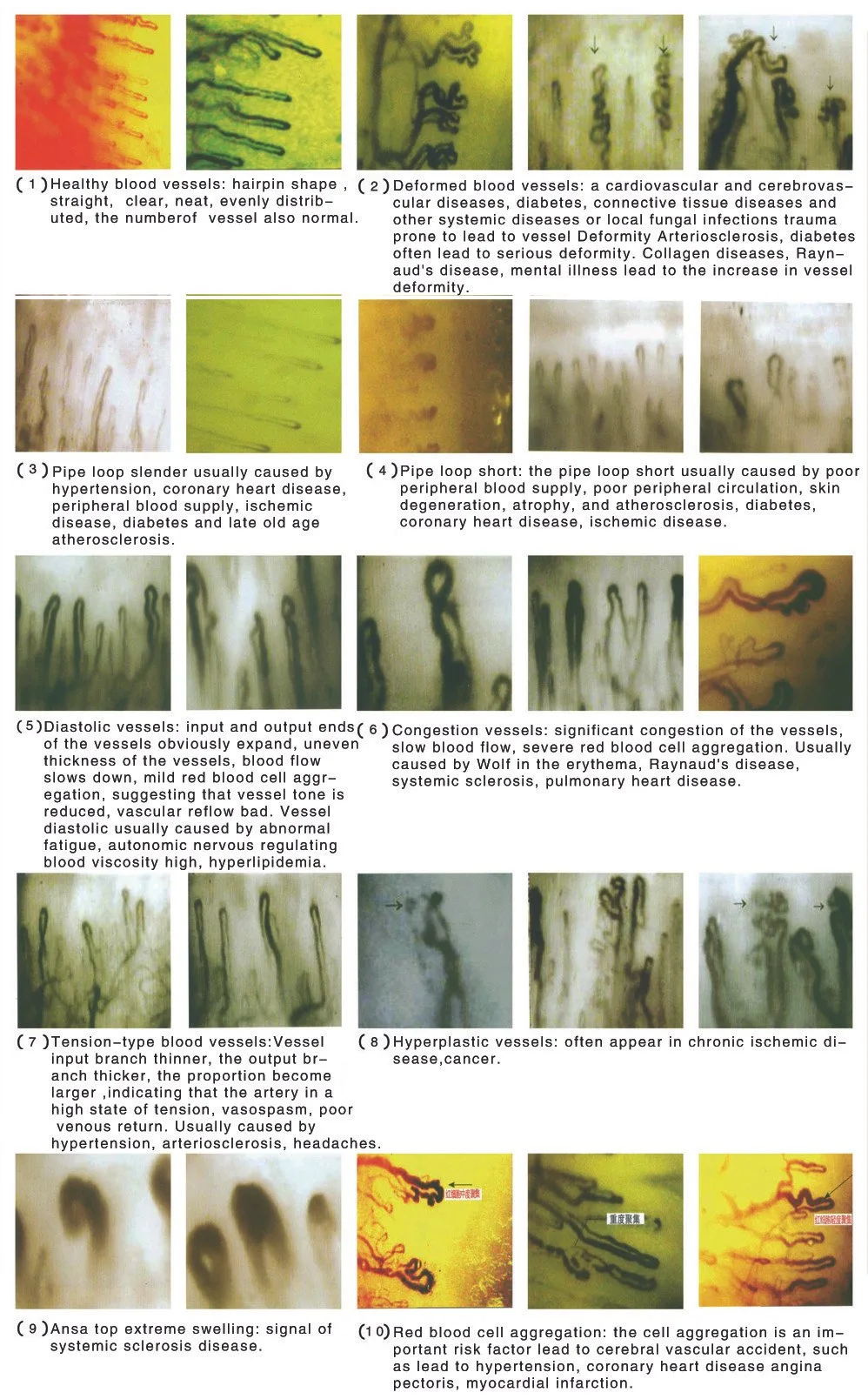 How to Compare Professional Nailfold Capillaroscopy Equipment: A Microscope-Based Buyer's Checklist for the U.S. Market — nail fold microscopy 12 - 副本.jpg