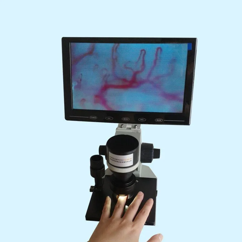Portable vs Benchtop Nailfold Capillaroscopy — direct answer for U.S. clinics — nail fold microscope 3 - 副本.jpg