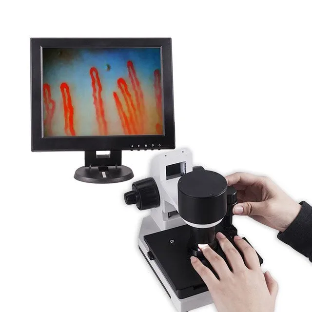 professional nailfold capillaroscope — tasly microcirculation machine.jpg