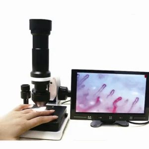 nailfold capillaroscopy magnifier — nail fold microscope 49.jpg